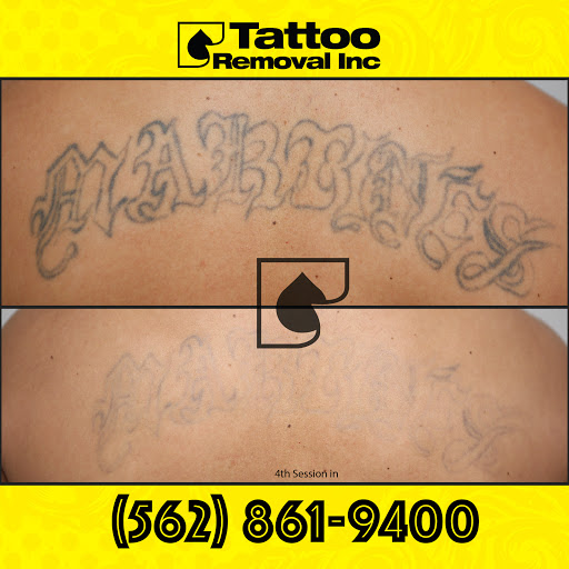Find cat tattoo ideas female for your next unique tattoo in South Gate at Tattoo Removal Inc