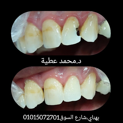 مركز د.محمد عطية لطب الأسنان