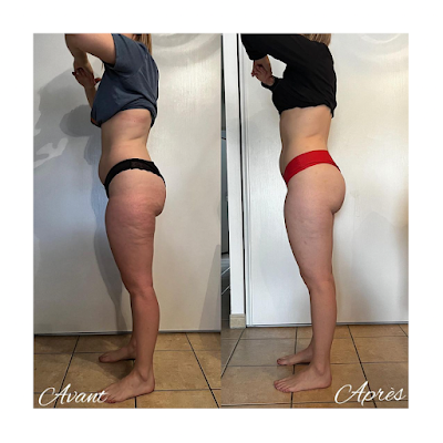 OCÉANE B - Massage à domicile - Drainage Renata Franca - Maderotherapie à Meyzieu