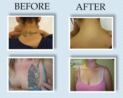 Explore feminine foot tattoo ideas, creative tattoo ideas in East Lansing, available at Lansing Laser Tattoo Removal