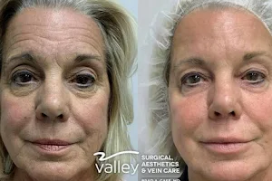 Valley Surgical, Aesthetics & Vein Care:Dr. Brad Case image