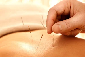 New Lynn Acupuncture image