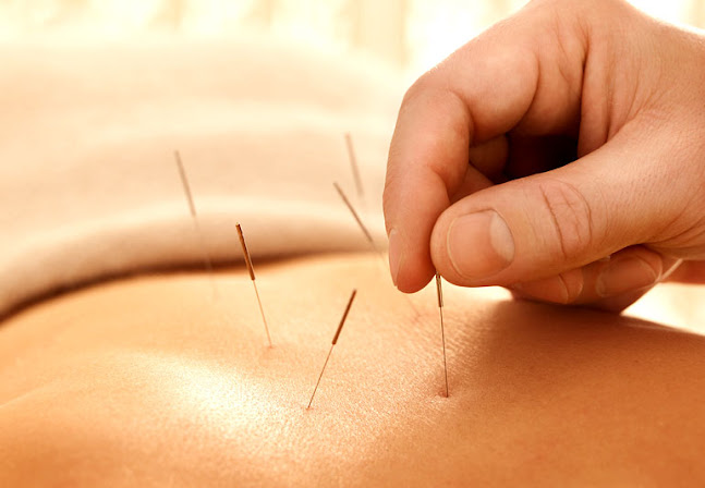 New Lynn Acupuncture