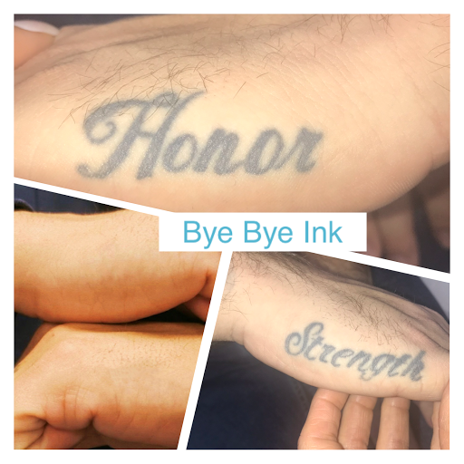 Explore the joker tattoo ideas, creative tattoo ideas in Middle Village, available at Bye Bye Ink Laser Tattoo Removal