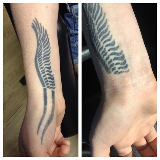 Explore cauldron tattoo ideas, creative tattoo ideas in Northampton, available at Removery Tattoo Removal & Fading