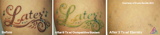 Explore tattoo shop name ideas, creative tattoo ideas in Fort Myers, available at Laser Tattoo Removal by Tatt Cemetery