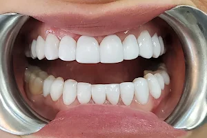 Klinika Usmiechu - Bonding zębów, Stomatolog Chorzów, Dentysta Chorzów, Implanty Katowice image