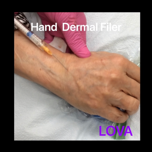 Explore roman numeral tattoo ideas, creative tattoo ideas in Lake Oswego, available at Lake Oswego Vein and Aesthetic LOVA