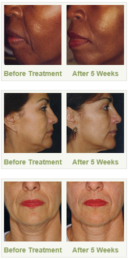 Explore destiny 2 hunter tattoo ideas, creative tattoo ideas in Sterling Heights, available at Skin & Vein Center