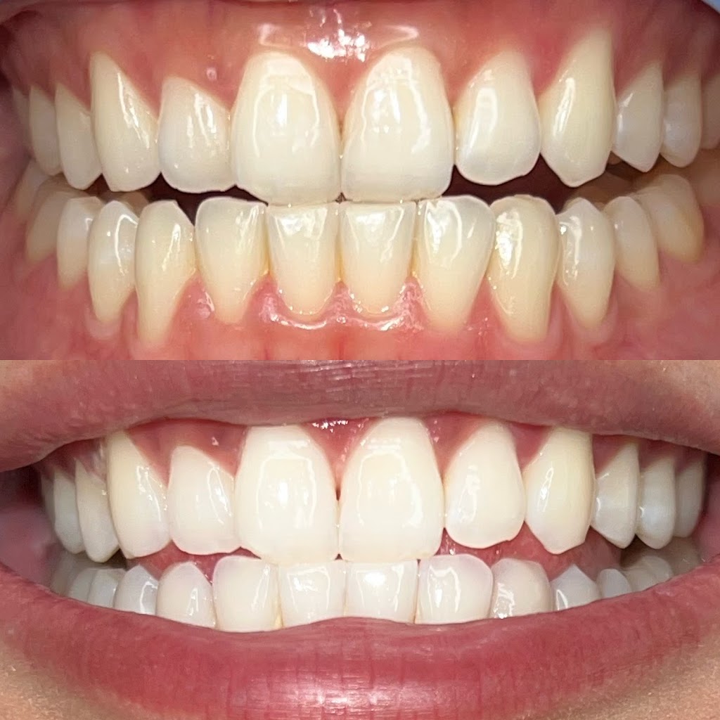 KPN Esthetics 98660