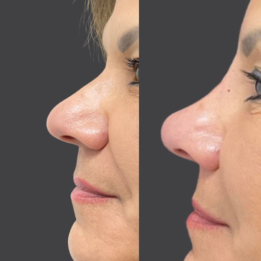 Explore wrap around tattoo ideas, creative tattoo ideas in Whittier, available at Skin Perfect Medical Aesthetics