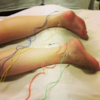 Best Health Option Acupuncture & Wellness - Photo 4 - Car repair in Germantown, WI, Milwaukee