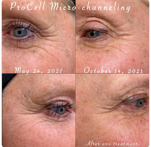 Find small sunflower tattoo ideas for your next unique tattoo in Vancouver at All You Aesthetics and Permanent Cosmetics