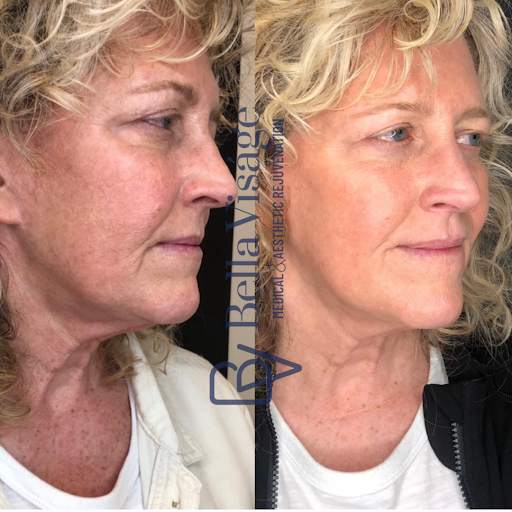 Explore memorial tattoo ideas for grandma, creative tattoo ideas in Lakeland, available at Bella Visge Medical & Aesthetic Rejuvenation