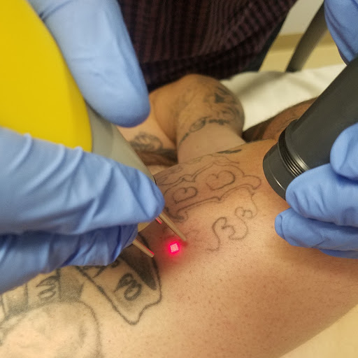 Explore tattoo sleeve ideas womens, creative tattoo ideas in Wakefield, available at New Beginnings Laser Tattoo Removal