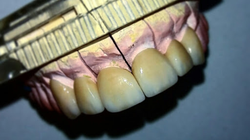 Logo da empresa - Incisivos Laboratório de Prótese dentária