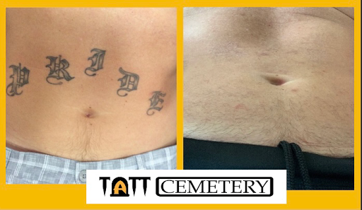 Explore tattoo ideas for black women, creative tattoo ideas in Fort Myers, available at Laser Tattoo Removal by Tatt Cemetery