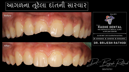 RAJKOT DENTAL - The Implant Centre - RAJKOT DENTAL - The Implant Centre