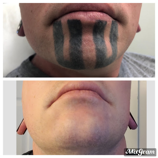 Explore book tattoo ideas for females, creative tattoo ideas in Longview, available at Vanish Laser Aesthetics