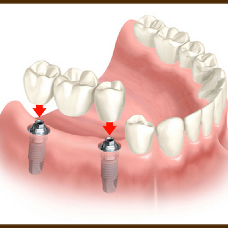 Family Dent | Dentista Roma e Ostia