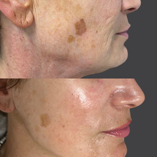 Explore tattoo position ideas, creative tattoo ideas in Whittier, available at Skin Perfect Medical Aesthetics