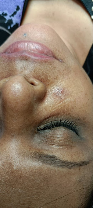 South Delhi Cosmetic Clinic - South Delhi Cosmetic Clinic