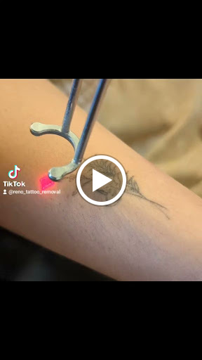 Find male tattoo ideas shoulder for your next unique tattoo in Reno at Reno Tattoo Removal