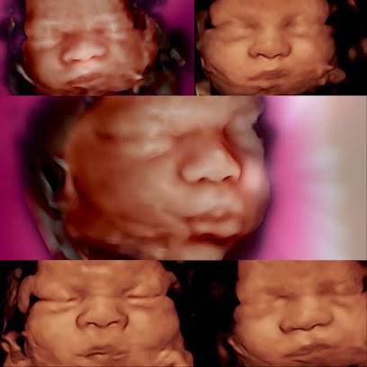 Ultrasound Techniques 3D/4D/5D baby imaging studio