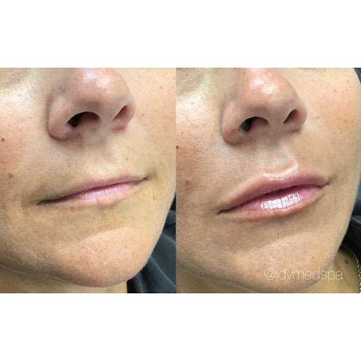 Explore back of hand tattoo ideas, creative tattoo ideas in Canton, available at JDV Med Spa