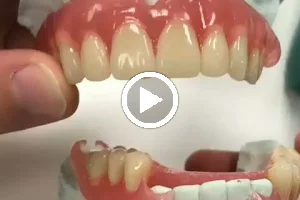 Tukang gigi rahmat dental image
