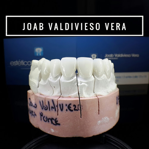 Opiniones de Estética Dental Manta - Dr. Joab Valdivieso Vera / Odontólogo en Manta - Dentista