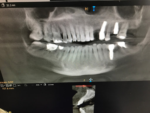 Implant Dentist of LA