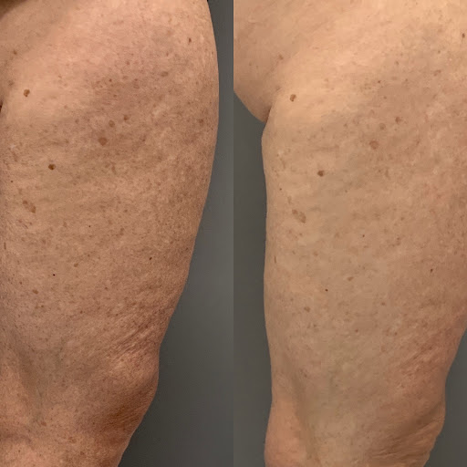 Beauty Salon «Glow Beauty Bar», reviews and photos, 4425 S Cobb Dr c, Smyrna, GA 30080, USA