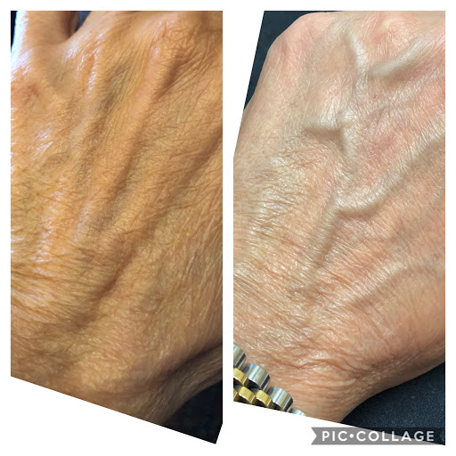 Medical Spa «New Image Medical Spa», reviews and photos, 680 Mowry Ave, Fremont, CA 94536, USA