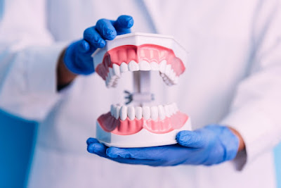 Moulage Ortho à Lançon-Provence