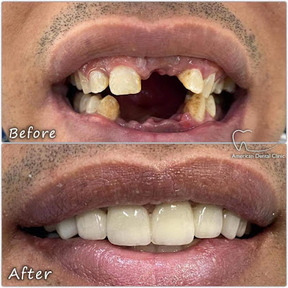 American Dental Clinic Egypt العيادة الامريكية لطب الاسنان مصر