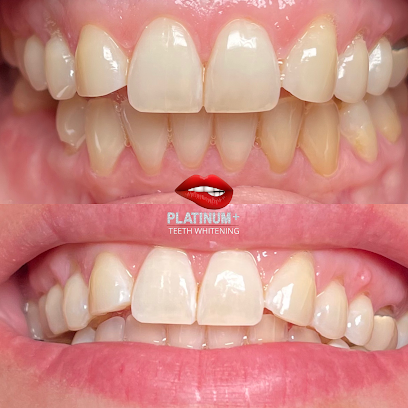 Platinum Plus Teeth Whitening LLC