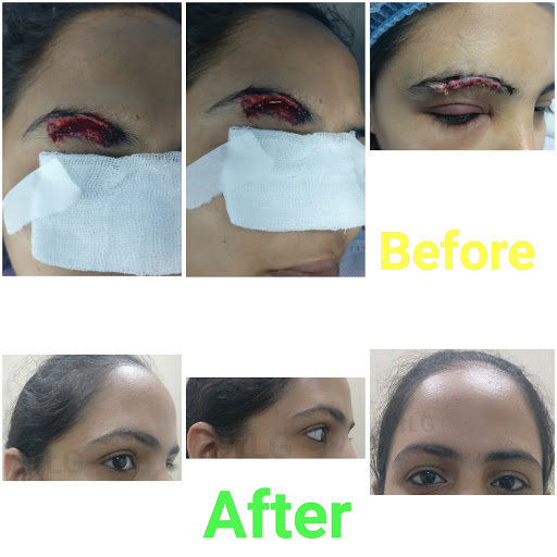 Siya Clinics - Cosmetic Facial Surgery