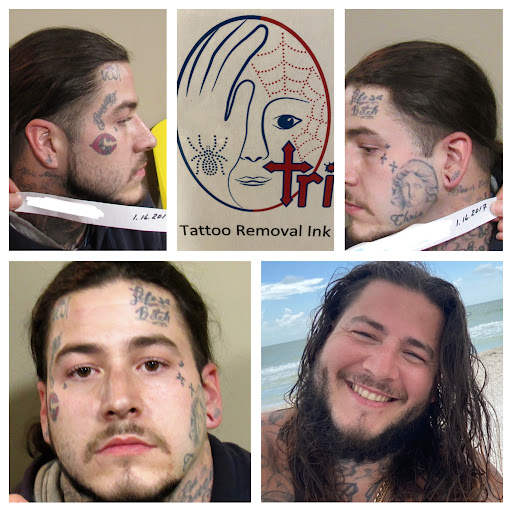 Explore r tattoo ideas, creative tattoo ideas in Covington, available at Tattoo Removal Ink, Inc.