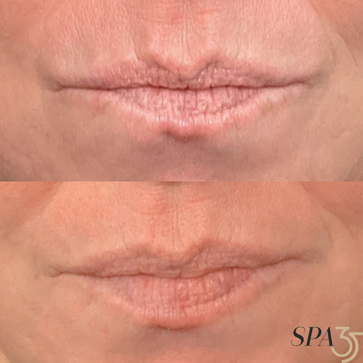 Explore chrome tattoo ideas, creative tattoo ideas in Boise, available at Spa 35 Med Spa