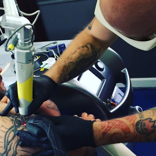 Explore preemie tattoo ideas, creative tattoo ideas in Reno, available at Reno Tattoo Removal