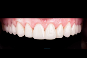 Dr.Teeth Dental Clinic-Advanced Microscopic Dental care image