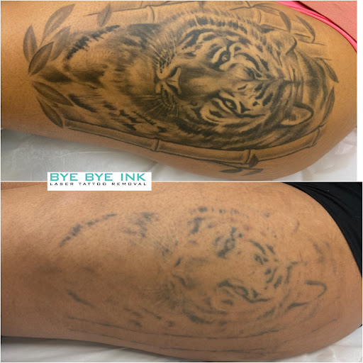 Explore letter tattoo ideas, creative tattoo ideas in Middle Village, available at Bye Bye Ink Laser Tattoo Removal