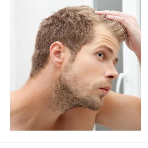 Downey Hair Loss Solutions SMP image
