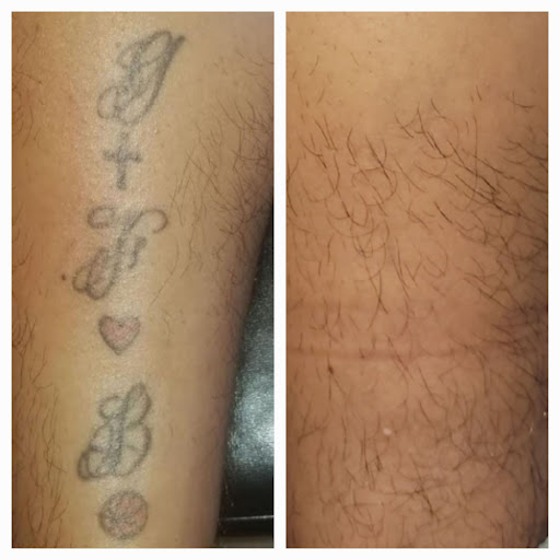 Explore steelers tattoo ideas, creative tattoo ideas in Houston, available at Htown Lasers