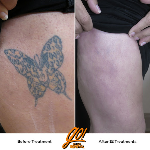 Explore passing away tattoo ideas, creative tattoo ideas in Allentown, available at Removery Tattoo Removal & Fading