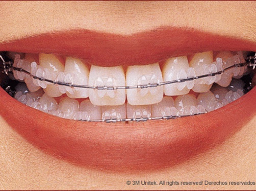 Natural Dent centro odontologico cusco