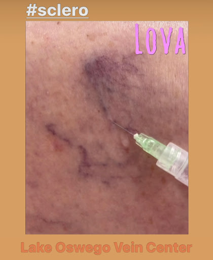 Explore tattoo ideas for father and daughter, creative tattoo ideas in Lake Oswego, available at Lake Oswego Vein and Aesthetic LOVA