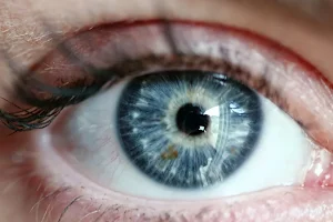 Lentics Augenärzte - Ihr Augenarzt in Rapperswil-Jona image
