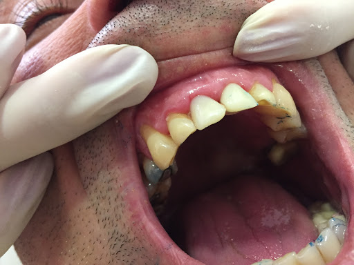 Información y opiniones sobre clinica dental Dr.Josep de Ribot de Gerona